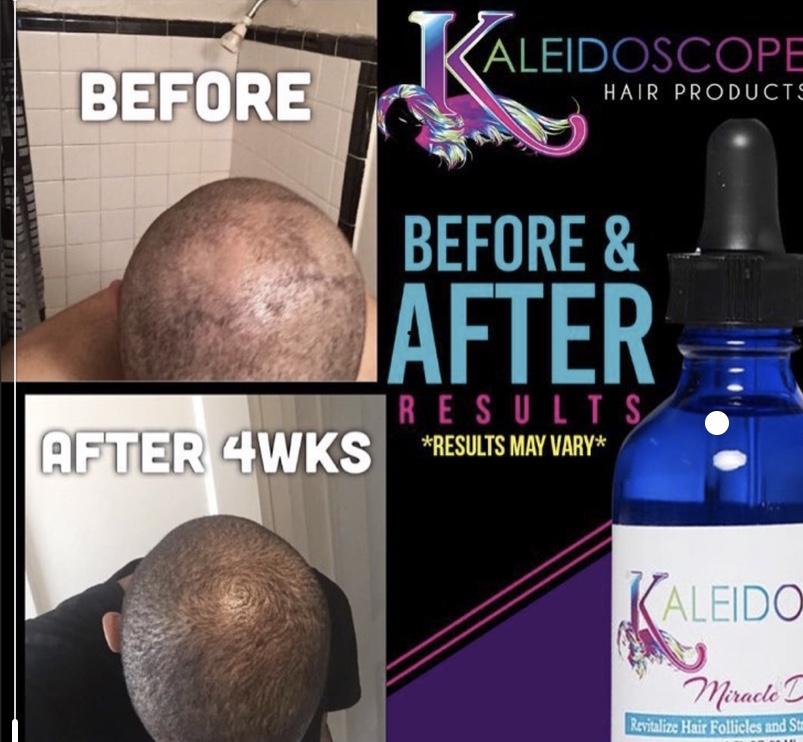 Kaleidoscope Miracle Drops